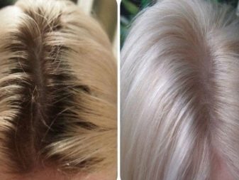 Blondex для освітлення волосся (13 фото): як використовувати засіб в домашніх умовах, щоб освітлити чорне волосся? Відгуки професіоналів