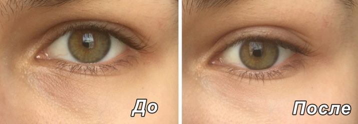 Для чого потрібні патчі під очі? Що це таке? Навіщо потрібні золоті та інші патчі?