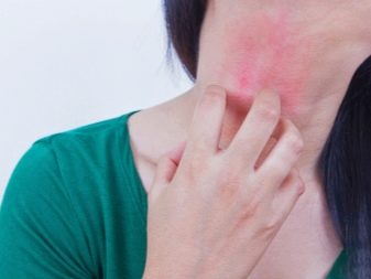 Анісова олія: інструкція по застосуванню і властивості ефірного масла для волосся