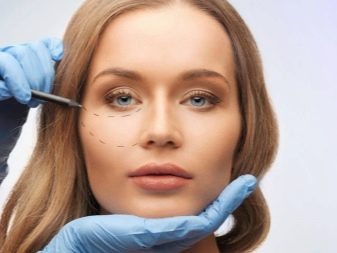 Juvederm Hydrate для біоревіталізації (19 фото): склад, ефект від курсу і відгуки косметологів