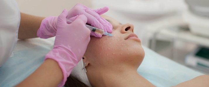 Juvederm Hydrate для біоревіталізації (19 фото): склад, ефект від курсу і відгуки косметологів