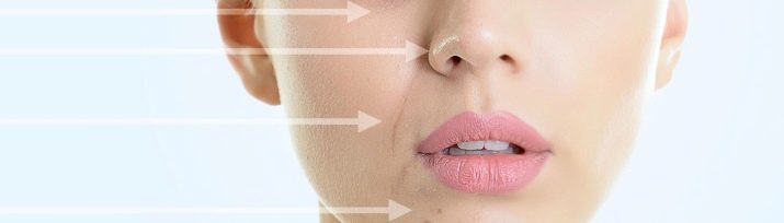 Juvederm Hydrate для біоревіталізації (19 фото): склад, ефект від курсу і відгуки косметологів