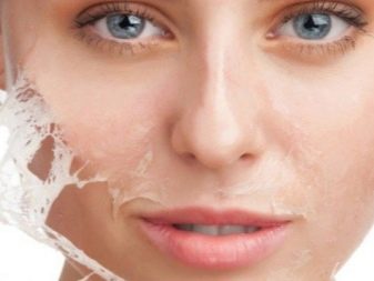 Juvederm Hydrate для біоревіталізації (19 фото): склад, ефект від курсу і відгуки косметологів