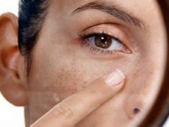 Juvederm Hydrate для біоревіталізації (19 фото): склад, ефект від курсу і відгуки косметологів