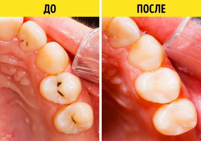 Імунологи дали 9 порад тим, кому набридло постійно хворіти