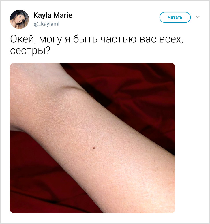 Ненавмисний твіт відкрив всьому світу, що практично у кожної дівчини є родимка на одному і тому ж місці