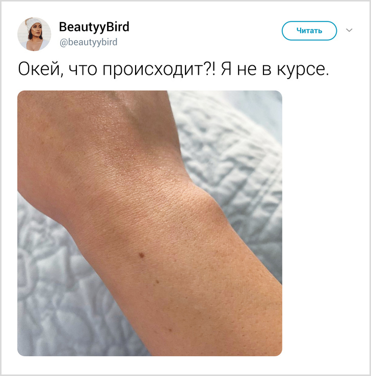 Ненавмисний твіт відкрив всьому світу, що практично у кожної дівчини є родимка на одному і тому ж місці