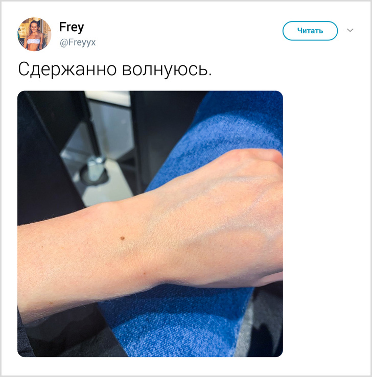 Ненавмисний твіт відкрив всьому світу, що практично у кожної дівчини є родимка на одному і тому ж місці
