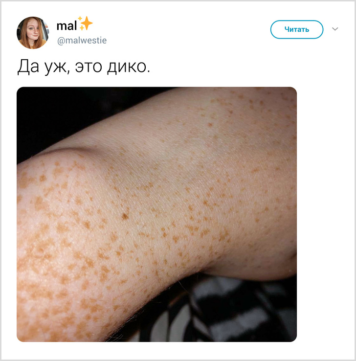 Ненавмисний твіт відкрив всьому світу, що практично у кожної дівчини є родимка на одному і тому ж місці