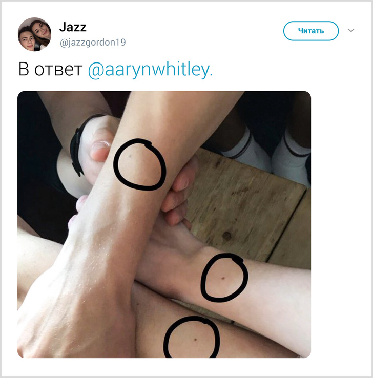 Ненавмисний твіт відкрив всьому світу, що практично у кожної дівчини є родимка на одному і тому ж місці