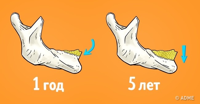 Один доказ, який переконає вас тут же сходити до стоматолога