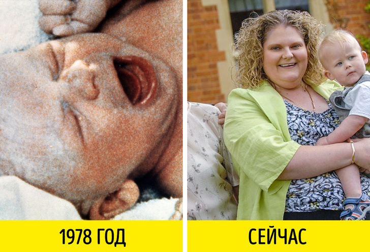 Правда і міфи про ЕКО, які повинні знати всі, хто планує завести дітей