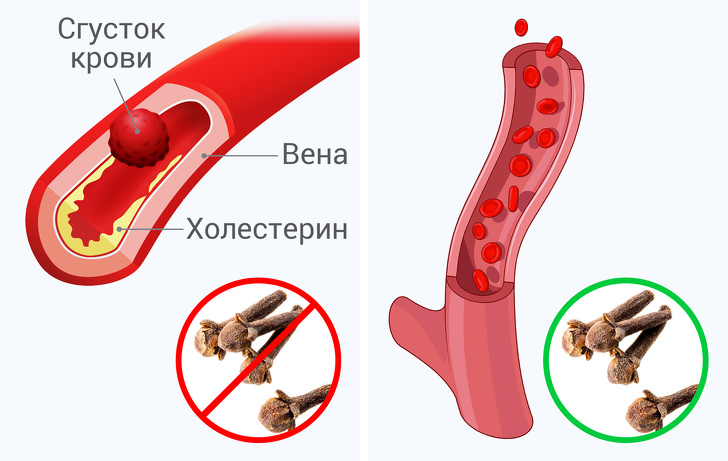 Що станеться з вашим тілом, якщо ви будете з’їдати по 2 бутона гвоздики в день