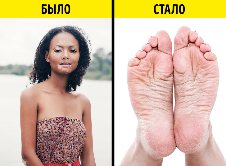 Що таке бодипозитив і чому це рух більше не працює