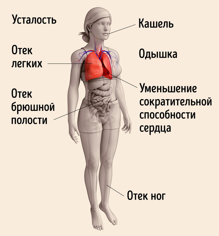 Що таке серцева недостатність і чому варто дізнатися про неї зараз і розповісти близьким