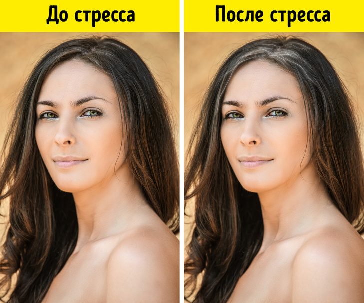 Вчені пояснили, звідки береться сивина і як з нею боротися